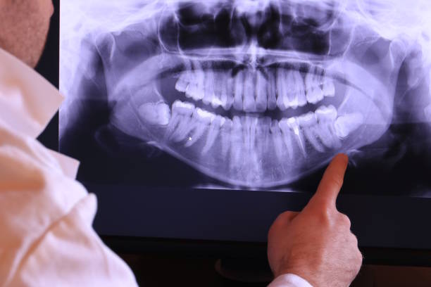Best Emergency Treatment for Toothache in Nellis Af, NV